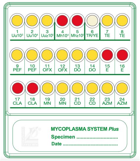 uriplasma|Iba pa.